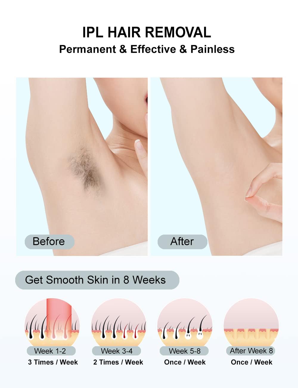 RadiantBare's IPL Laser Hair Removal Device for Women and Men, Painless Full Body & Face Hair Removal System at Home