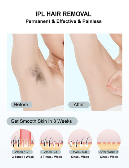 RadiantBare's IPL Laser Hair Removal Device for Women and Men, Painless Full Body & Face Hair Removal System at Home